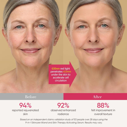 Auralift Lumi Facial Wand